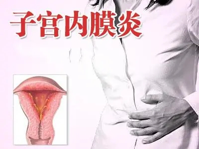 子宫内膜炎的症状是什么